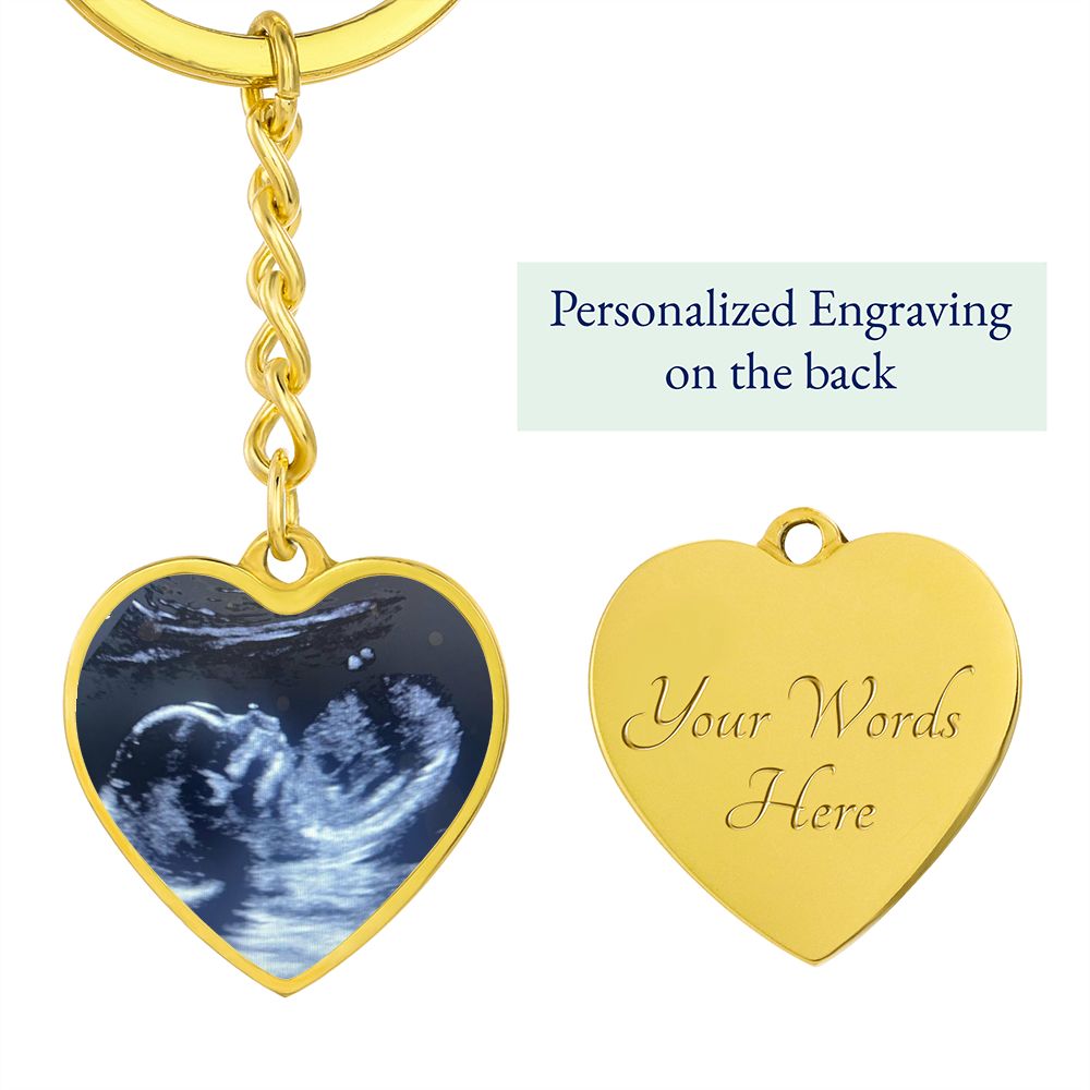 CUSTOM - Ultrasound keychain Ali